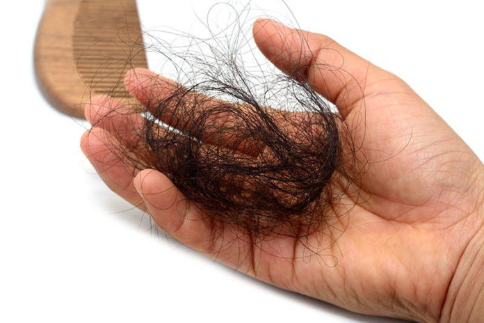 Understanding Hair Loss: Getting to the Root of the Problem